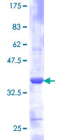 RPS21 / Ribosomal Protein S21 Protein - 12.5% SDS-PAGE of human RPS21 stained with Coomassie Blue
