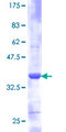 RPS21 / Ribosomal Protein S21 Protein - 12.5% SDS-PAGE of human RPS21 stained with Coomassie Blue