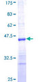 RPS23 / Ribosomal Protein S23 Protein - 12.5% SDS-PAGE Stained with Coomassie Blue.