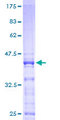 RPS25 / Ribosomal Protein S25 Protein - 12.5% SDS-PAGE of human RPS25 stained with Coomassie Blue