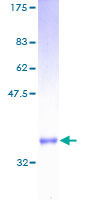RPS27 / Ribosomal Protein S27 Protein - 12.5% SDS-PAGE of human RPS27 stained with Coomassie Blue