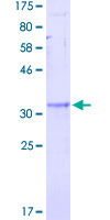 RPS27A Protein - 12.5% SDS-PAGE of human RPS27A stained with Coomassie Blue