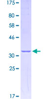 RPS27A Protein - 12.5% SDS-PAGE of human RPS27A stained with Coomassie Blue