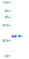 RPS28 / Ribosomal Protein S28 Protein - 12.5% SDS-PAGE of human RPS28 stained with Coomassie Blue