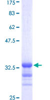 RPS28 / Ribosomal Protein S28 Protein - 12.5% SDS-PAGE Stained with Coomassie Blue.