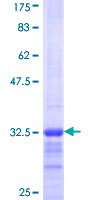 RPS29 / Ribosomal Protein S29 Protein - 12.5% SDS-PAGE Stained with Coomassie Blue.