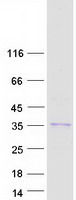 RPS2P40  Protein - Purified recombinant protein LOC91561 was analyzed by SDS-PAGE gel and Coomassie Blue Staining