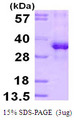 RPS3 / Ribosomal Protein S3 Protein