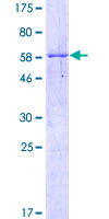 RPS3A / Ribosomal Protein S3A Protein - 12.5% SDS-PAGE of human RPS3A stained with Coomassie Blue