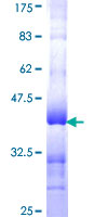 RPS3A / Ribosomal Protein S3A Protein - 12.5% SDS-PAGE Stained with Coomassie Blue.