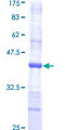 RPS4X Protein - 12.5% SDS-PAGE Stained with Coomassie Blue.