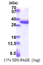 RPS4X Protein