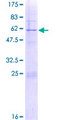 RPS4Y1 Protein - 12.5% SDS-PAGE of human RPS4Y1 stained with Coomassie Blue