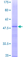 RPS5 / Ribosomal Protein S5 Protein - 12.5% SDS-PAGE of human RPS5 stained with Coomassie Blue