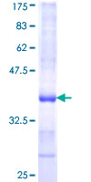 RPS5 / Ribosomal Protein S5 Protein - 12.5% SDS-PAGE Stained with Coomassie Blue.