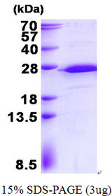 RPS5 / Ribosomal Protein S5 Protein