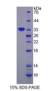 RPS6KA1 / RSK1 Protein - Recombinant  Ribosomal Protein S6 Kinase Alpha 1 By SDS-PAGE