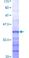 RPS6KA2 / RSK3 Protein - 12.5% SDS-PAGE Stained with Coomassie Blue.