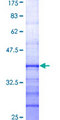 RPS6KA2 / RSK3 Protein - 12.5% SDS-PAGE Stained with Coomassie Blue.