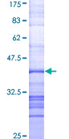 RPS6KA3 / RSK2 Protein - 12.5% SDS-PAGE Stained with Coomassie Blue.