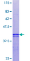 RPS6KA5 / MSK1 Protein - 12.5% SDS-PAGE Stained with Coomassie Blue.