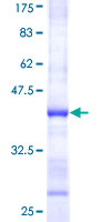 RPS6KA6 / RSK4 Protein - 12.5% SDS-PAGE Stained with Coomassie Blue.
