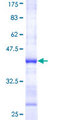 RPS6KA6 / RSK4 Protein - 12.5% SDS-PAGE Stained with Coomassie Blue.