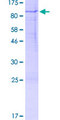 RPS6KB1 / P70S6K / S6K Protein - 12.5% SDS-PAGE of human RPS6KB1 stained with Coomassie Blue