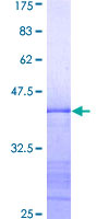 RPS6KB1 / P70S6K / S6K Protein - 12.5% SDS-PAGE Stained with Coomassie Blue.