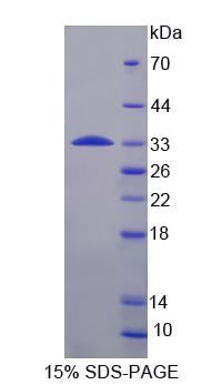 RPS6KB1 / P70S6K / S6K Protein - Recombinant  Ribosomal Protein S6 Kinase Beta 1 By SDS-PAGE