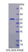 RPS6KB1 / P70S6K / S6K Protein - Recombinant  Ribosomal Protein S6 Kinase Beta 1 By SDS-PAGE
