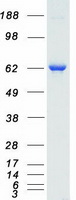 RPS6KB1 / P70S6K / S6K Protein - Purified recombinant protein RPS6KB1 was analyzed by SDS-PAGE gel and Coomassie Blue Staining