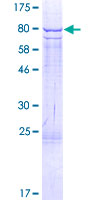 RPS6KB2 / S6K2 Protein - 12.5% SDS-PAGE of human RPS6KB2 stained with Coomassie Blue