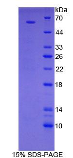 RPS6KB2 / S6K2 Protein - Recombinant Ribosomal Protein S6 Kinase Beta 2 By SDS-PAGE