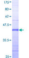 RPS6KC1 Protein - 12.5% SDS-PAGE Stained with Coomassie Blue.