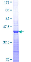 RPS7 / Ribosomal Protein S7 Protein - 12.5% SDS-PAGE Stained with Coomassie Blue.