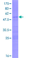 RPS8 / Ribosomal Protein S8 Protein - 12.5% SDS-PAGE of human RPS8 stained with Coomassie Blue