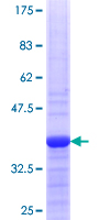 RPS8 / Ribosomal Protein S8 Protein - 12.5% SDS-PAGE Stained with Coomassie Blue.