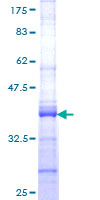 RPS9 /  Ribosomal Protein S9 Protein - 12.5% SDS-PAGE Stained with Coomassie Blue.