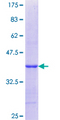 RPS9 /  Ribosomal Protein S9 Protein - 12.5% SDS-PAGE Stained with Coomassie Blue.