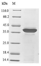 RPSA / Laminin Receptor Protein - (Tris-Glycine gel) Discontinuous SDS-PAGE (reduced) with 5% enrichment gel and 15% separation gel.