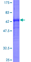 RPSA / Laminin Receptor Protein - 12.5% SDS-PAGE of human RPSA stained with Coomassie Blue