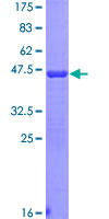 RPSA / Laminin Receptor Protein - 12.5% SDS-PAGE Stained with Coomassie Blue.