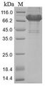 RPSA / Laminin Receptor Protein - (Tris-Glycine gel) Discontinuous SDS-PAGE (reduced) with 5% enrichment gel and 15% separation gel.