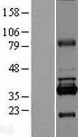 RPUSD1 Protein - Western validation with an anti-DDK antibody * L: Control HEK293 lysate R: Over-expression lysate