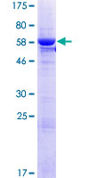 RPUSD1 Protein - 12.5% SDS-PAGE of human RPUSD1 stained with Coomassie Blue