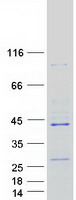 RPUSD1 Protein - Purified recombinant protein RPUSD1 was analyzed by SDS-PAGE gel and Coomassie Blue Staining