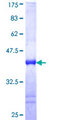 RRAD Protein - 12.5% SDS-PAGE Stained with Coomassie Blue