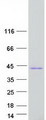 RRAD Protein - Purified recombinant protein RRAD was analyzed by SDS-PAGE gel and Coomassie Blue Staining