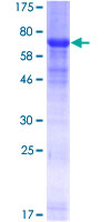 RRAGC / RAGC Protein - 12.5% SDS-PAGE of human RRAGC stained with Coomassie Blue